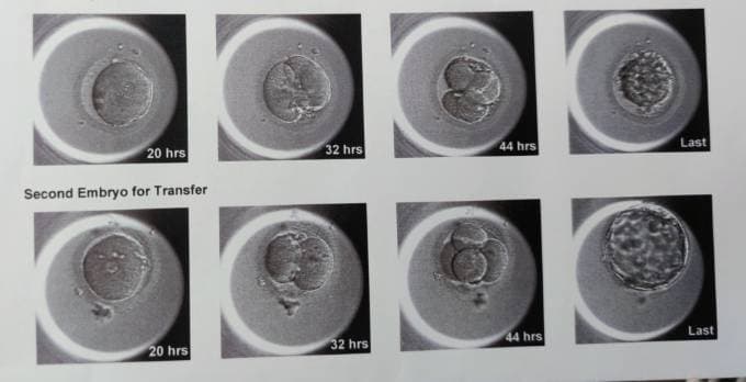 Advanced Embryology & ICSI Certification